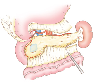 Pancrease_30-2